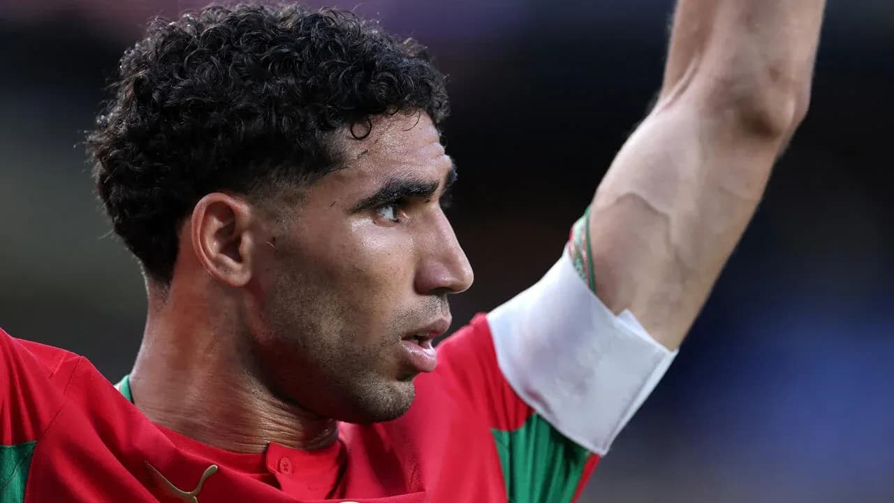Jugador levantando el brazo durante el partido
